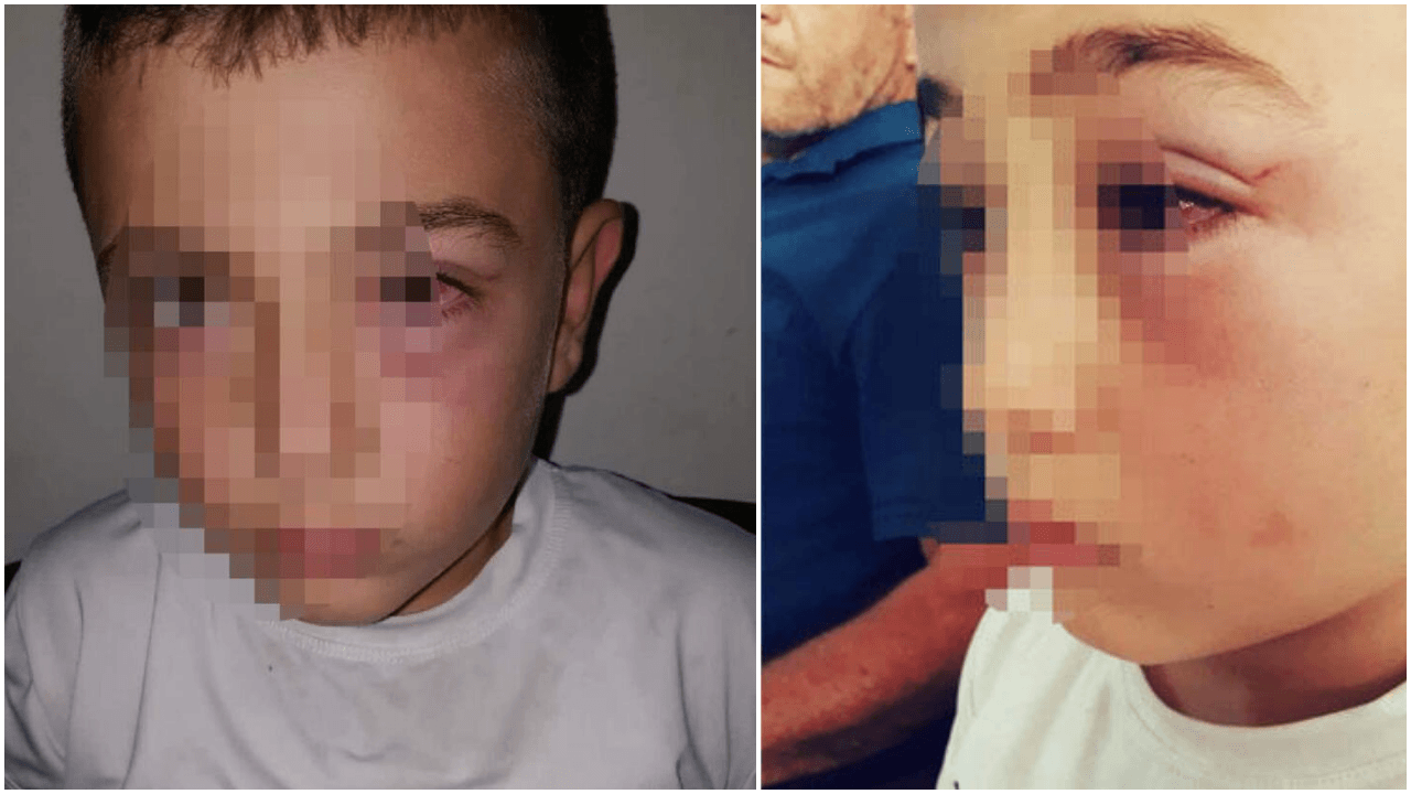 9 yaşındaki çocuğu okul arkadaşının babası dövdü!