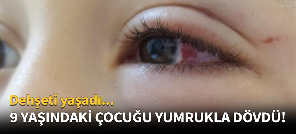 Oğluyla tartışan çocuğu yumrukla dövdü!