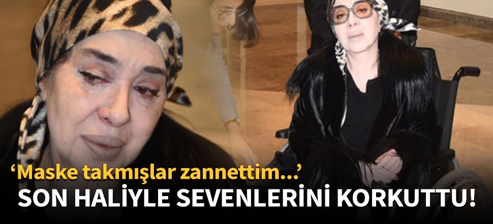 Son haliyle sevenlerini korkuttu!