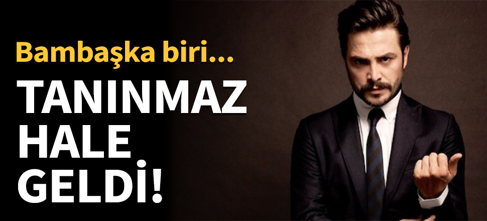 Ahmet Kural tanınmaz halde!