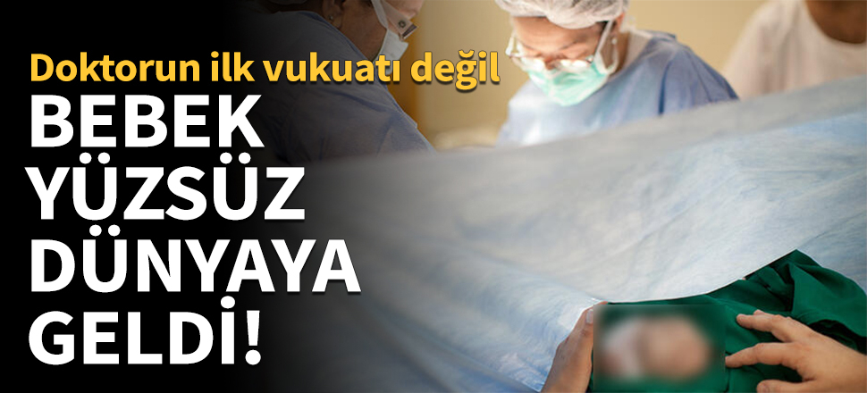 Portekiz'de bir bebek yüzsüz dünyaya geldi!