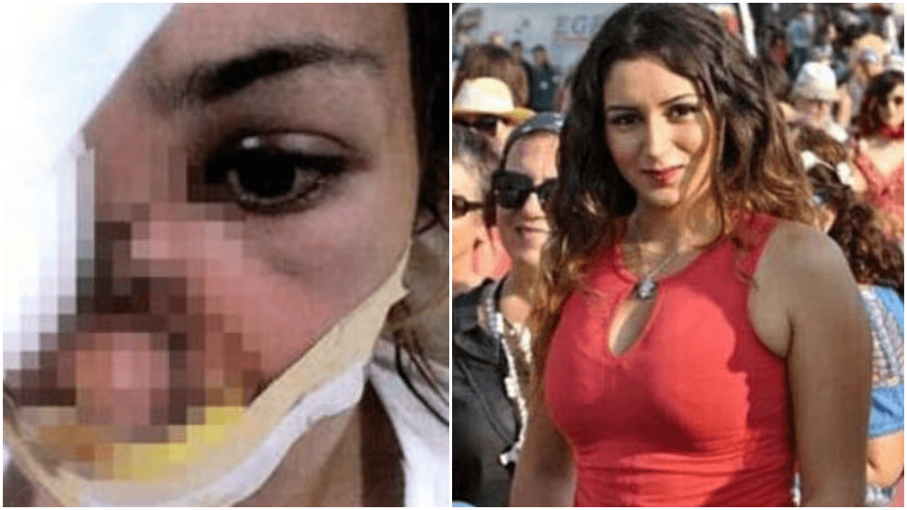Yüzünden vurdu, tehditle evlendi, şiddet hiç bitmedi!