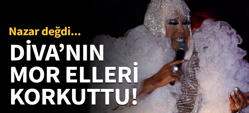 Diva'nın mor elleri korkuttu!