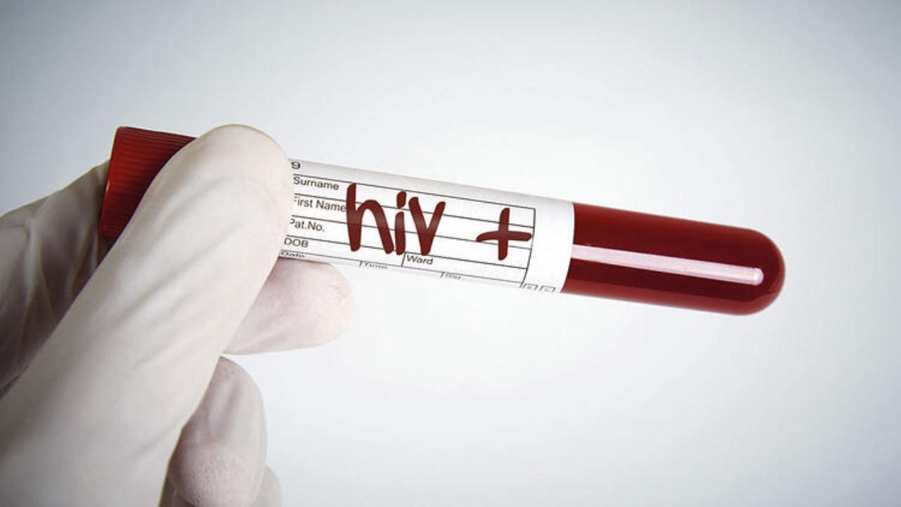 Bilim insanları yeni HIV türü keşfetti!