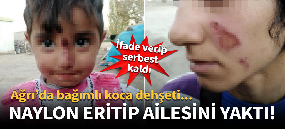 Naylon eriterek ailesini yaktı!