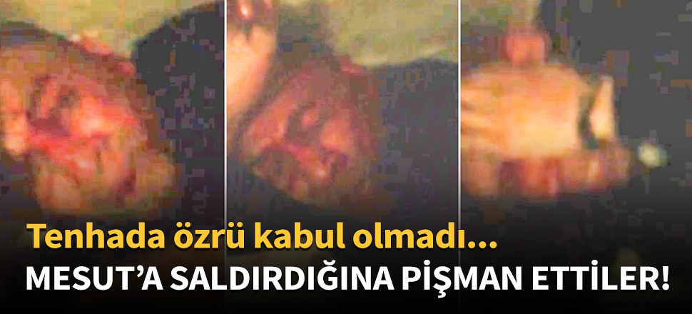 Mesut'a bıçakla saldıran gaspçıyı dövdüler!