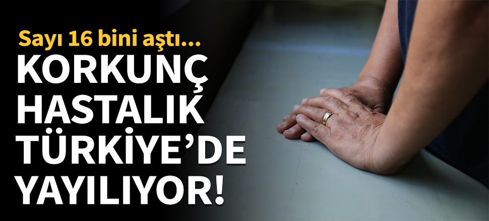 Korkunç hastalık Türkiye'de yayılıyor!