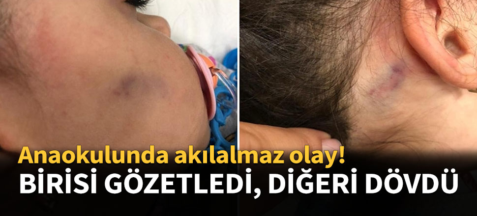 Birisi gözetledi, diğeri dövdü...