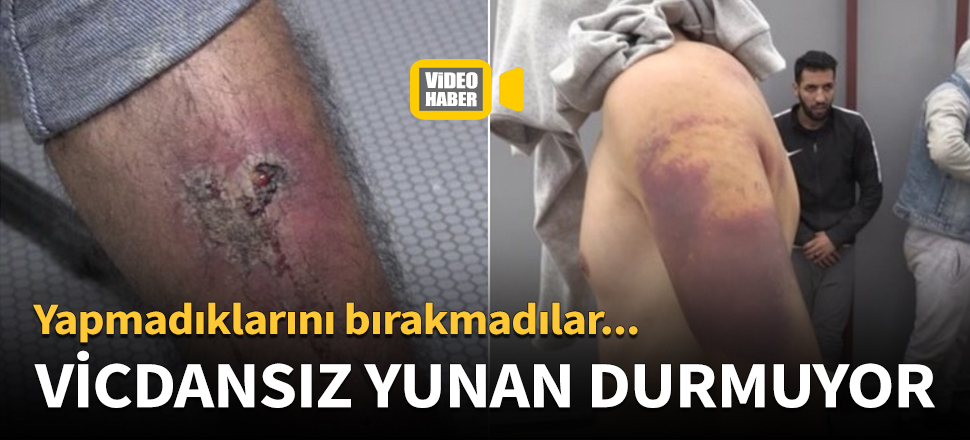 Vicdansız Yunan askeri durmuyor! Üzerlerinde sigara söndürdüler...