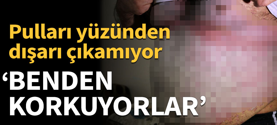 Pulları dükülüyor diye kimse konuşmuyor