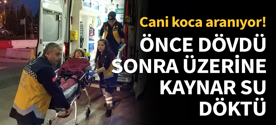 Önce dövdü, ardından üzerine kaynar su döktü!
