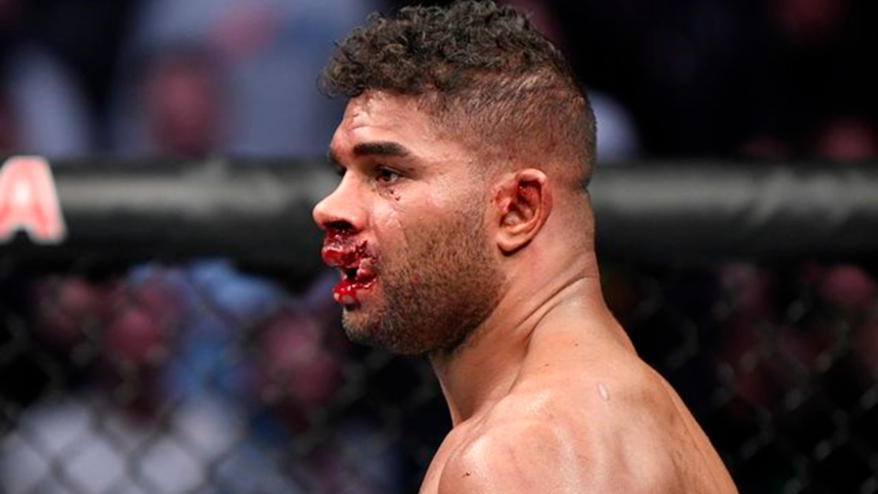 Alistair Overeem'in dudağı ikiye bölündü!