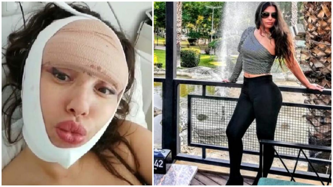 Estetik tutkusunu dizginleyemiyor! 23. kez bıçak altına yatacak...