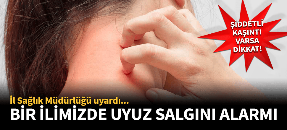 Büyük tehlike! Bir ilimizde uyuz salgını başladı...