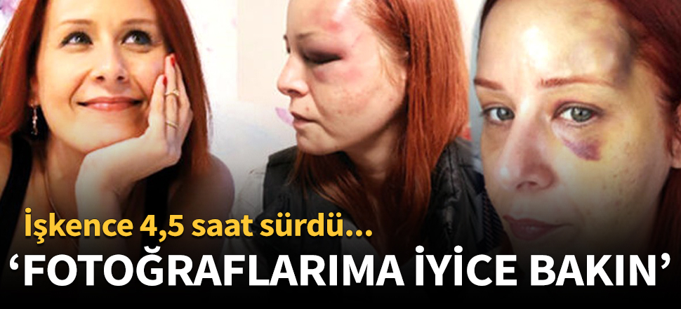 Deniz Soysal, yaşadığı 4,5 saatlik dehşeti anlattı