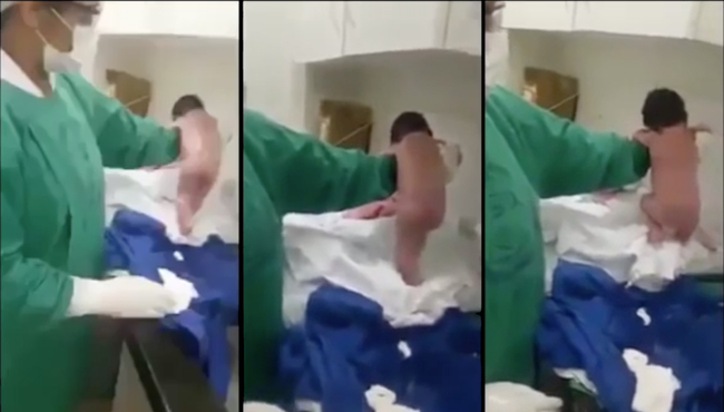 Doğum ekibi şoke oldu, bebek doğar doğmaz yürümeye çalıştı!