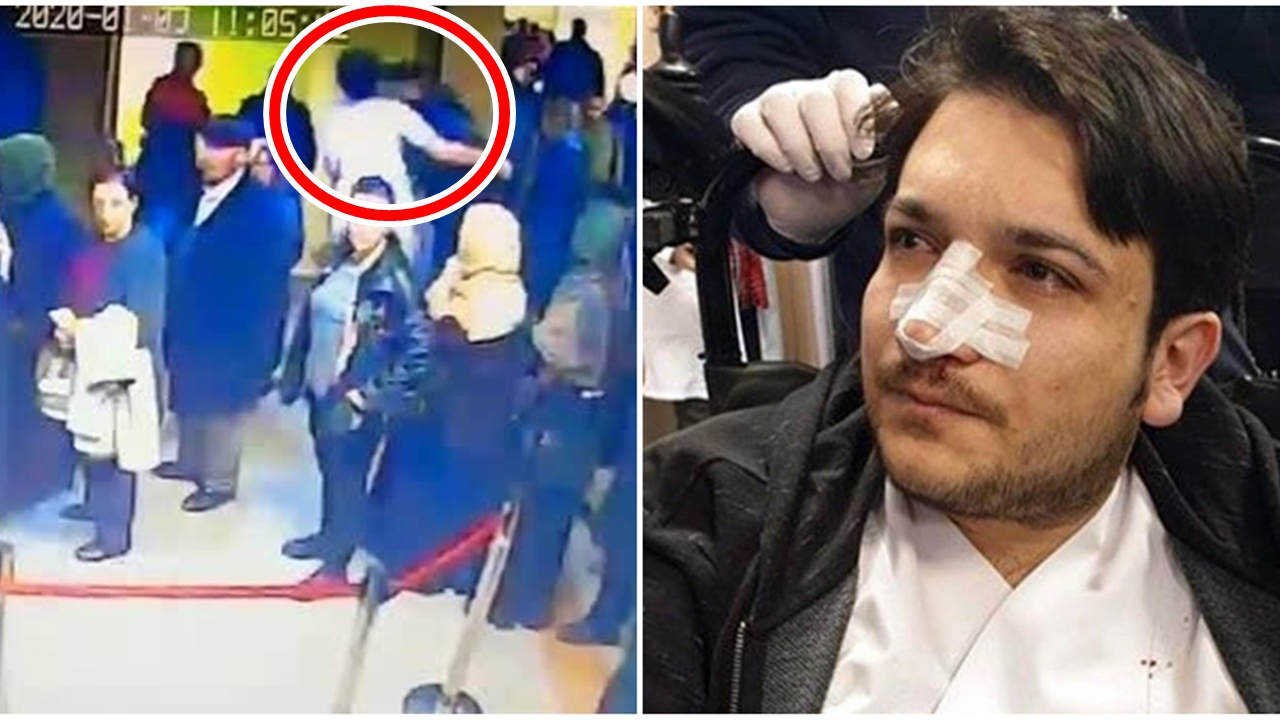 Doktorun burnunu kırdı...