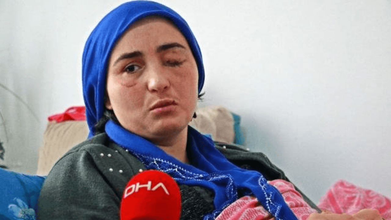 Eşi tarafından şiddete uğrayan kadın gözünü kaybetti!