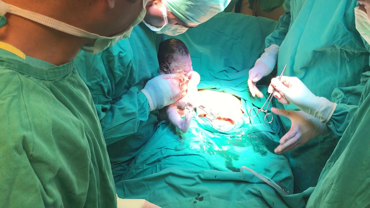 Darp edilen doktor kırık burunla doğuma girdi!