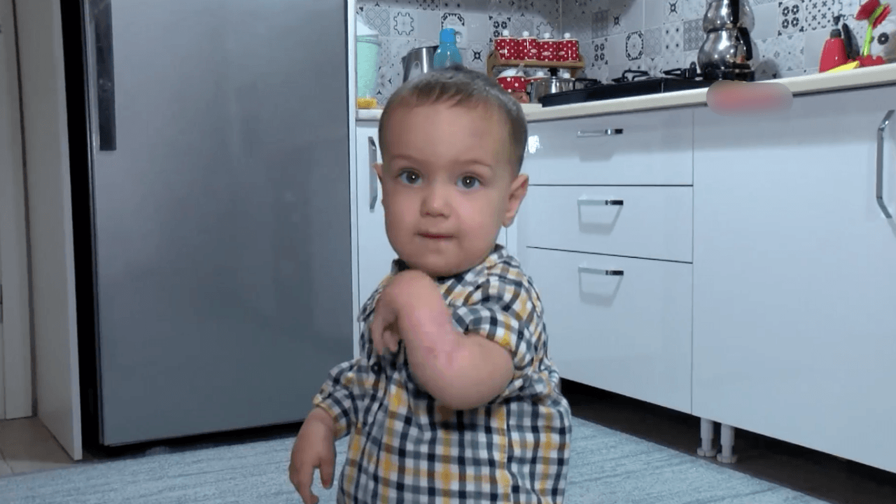 Kolunda yara ile doğdu! Şimdi elini kullanamıyor...