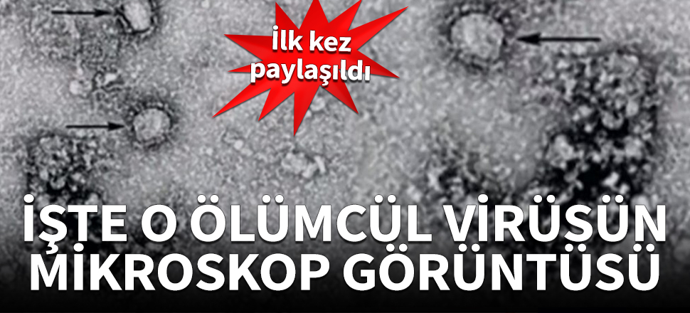 Ölümcül virüsün mikroskop görüntüsü yayınlandı