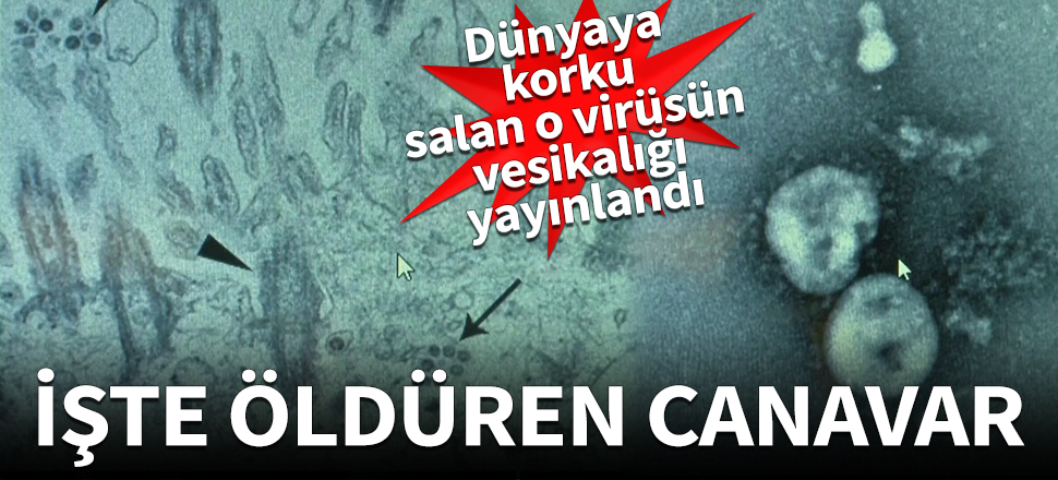 Korona virüsünün vesikalığı yayınlandı