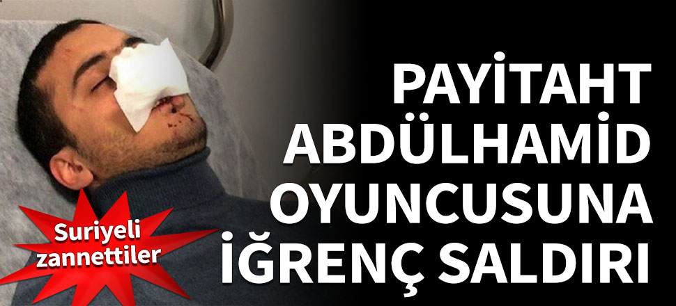 Payitaht Abdülhamid oyuncusuna dayak