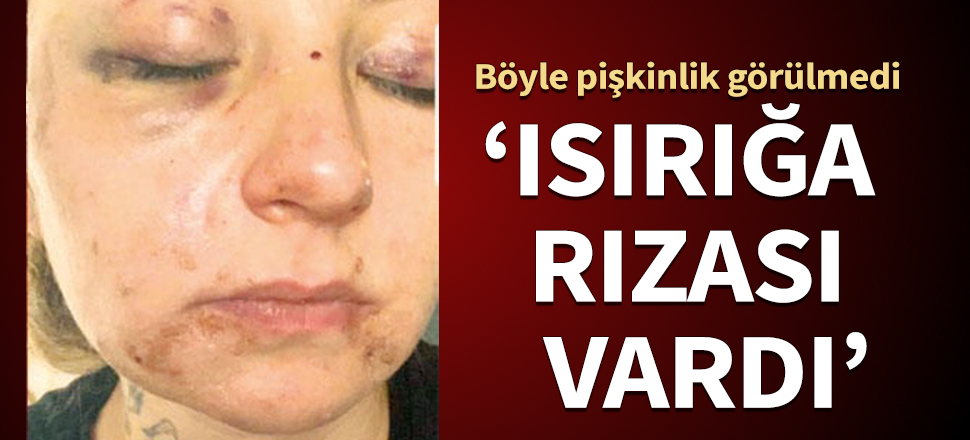Böyle pişkinlik görülmedi: Isırığa rızası vardı...