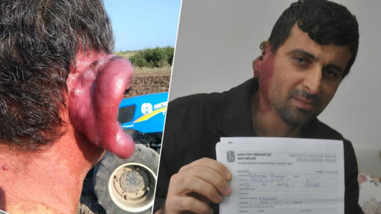7 yıldır kimse çare bulamadı! Kulağının her tarafını sarıyor