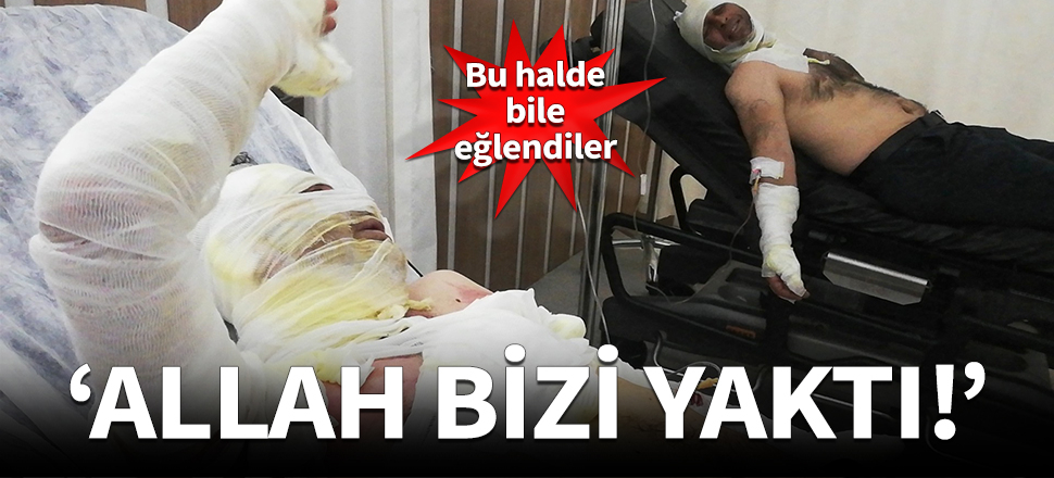 Bu halde bile eğlendiler: Allah bizi yaktı!