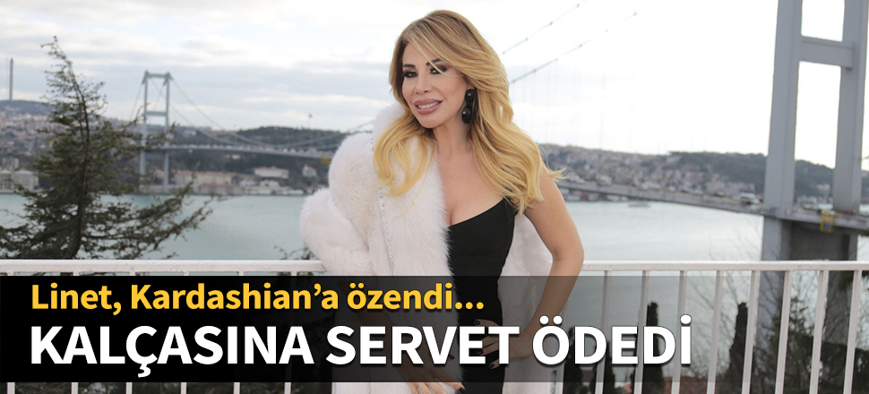 Linet kalçasına servet ödedi
