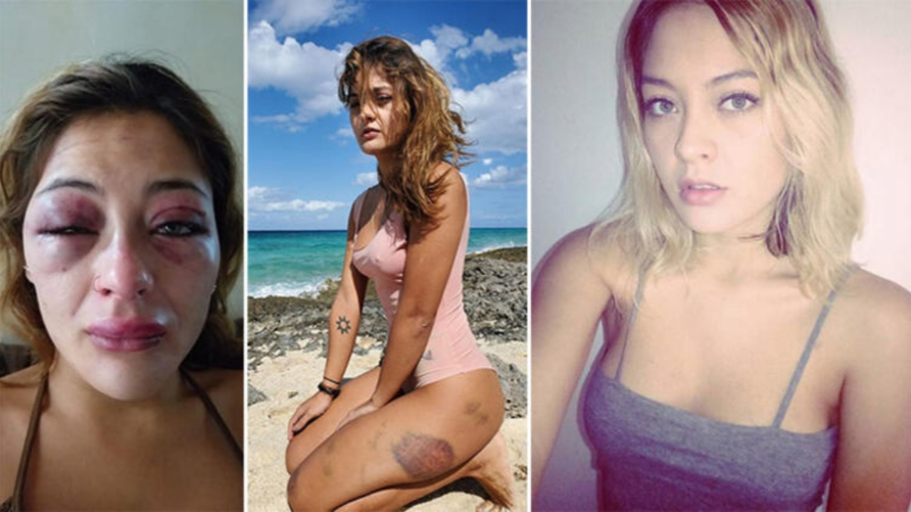 Güzel model dehşeti yaşadı! Her detayı korkunç...