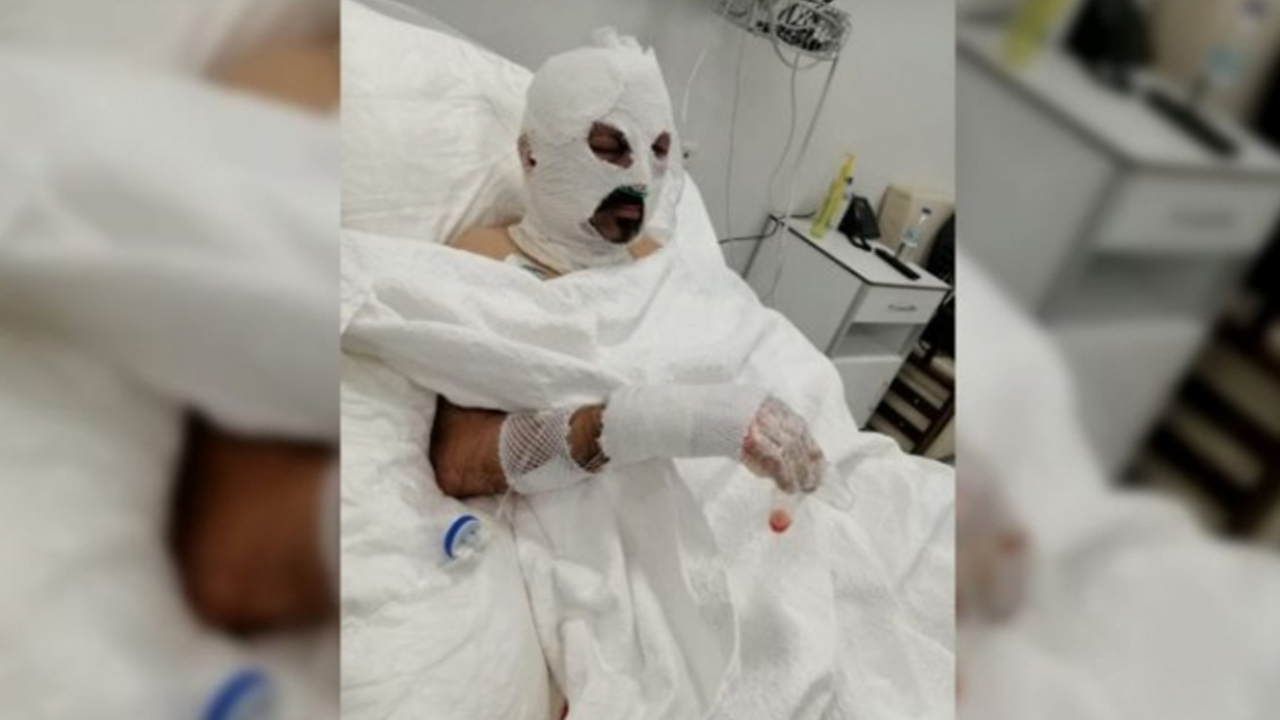 Öğrenci servisi şoförünün üzerine tiner döküp, yakan kadın tutuklandı