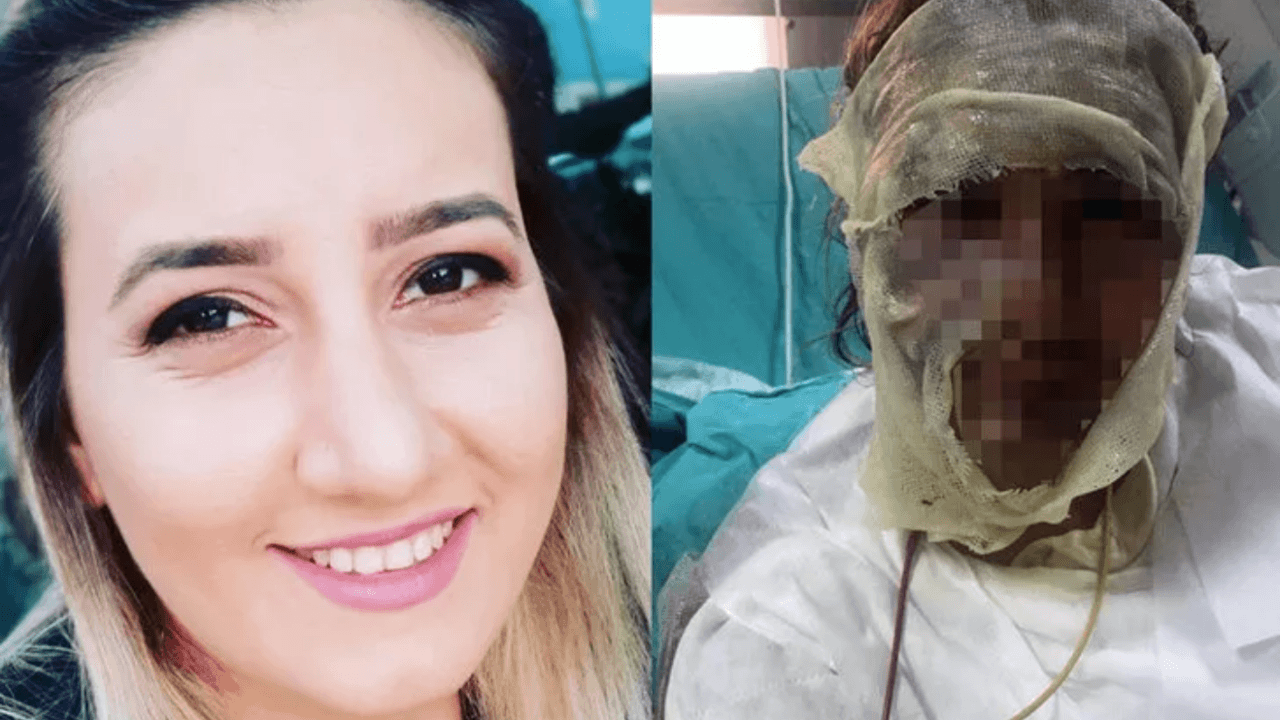 Onu bu hale getiren sevgilisinden şikayetçi olmadı
