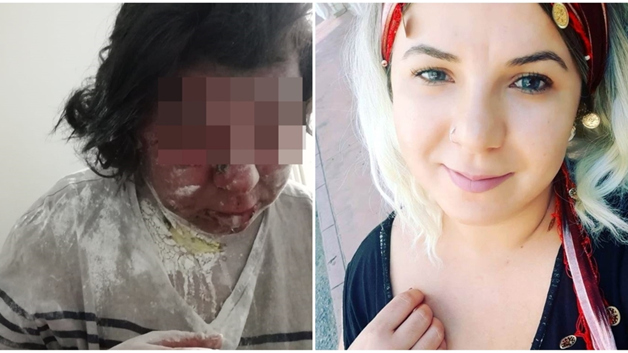 Antibiyotik yüzünden tanınmaz hale geldi...