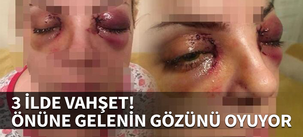 3 ilde vahşet! Önüne gelenin gözünü oyuyor...