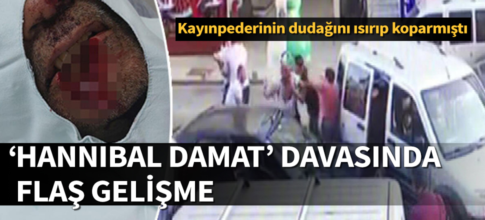 Kayınpederinin dudağını ısıran damada 23 yıl hapis istemi