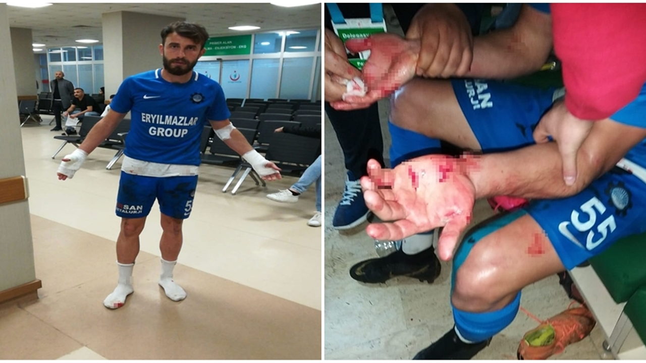 Soyunma odasını basıp futbolcuları bıçakladılar!