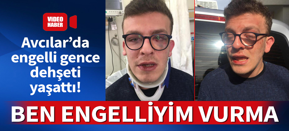 Avcılar'da otizmli gence dayak