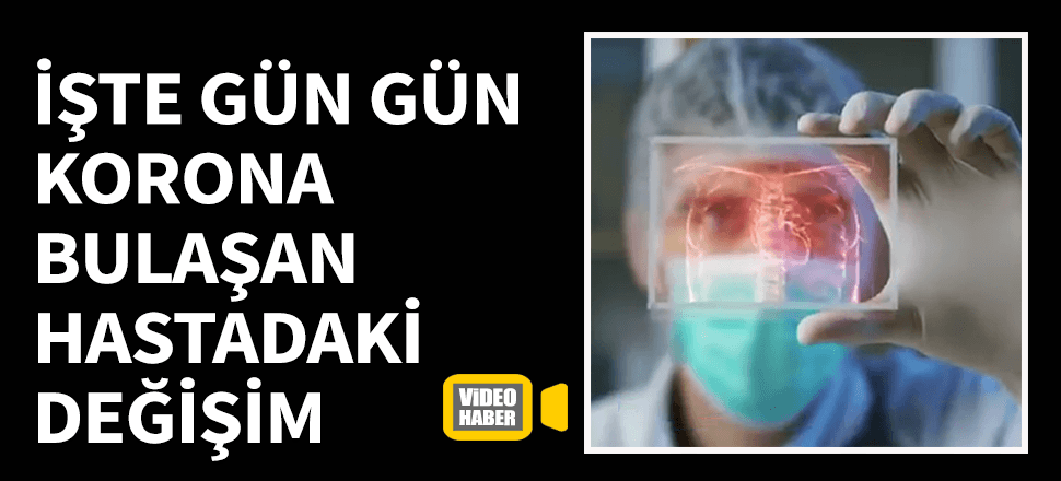 İşte gün gün korana virüs bulaşan kişideki değişim