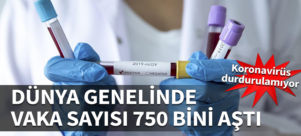 Dünya üzerinde vaka sayısı 750 bini aştı!