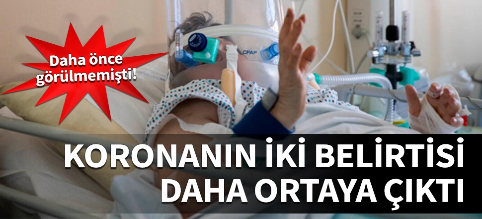 Daha önce görülmemişti! Koronanın iki belirtisi daha ortaya çıktı