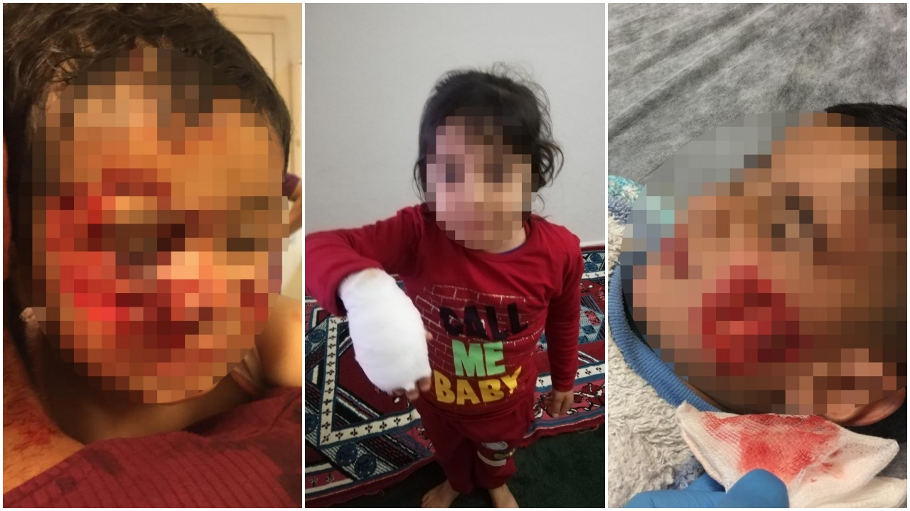 Şanlıurfa'da dehşete düşüren olay! 6 çocuğu bu hale getirdiler