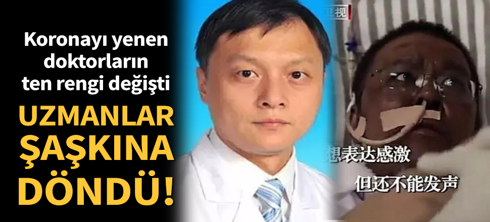Son dakika... Salgının başladığı Çin’de koronavirüsü yenen doktorların ten rengi değişti