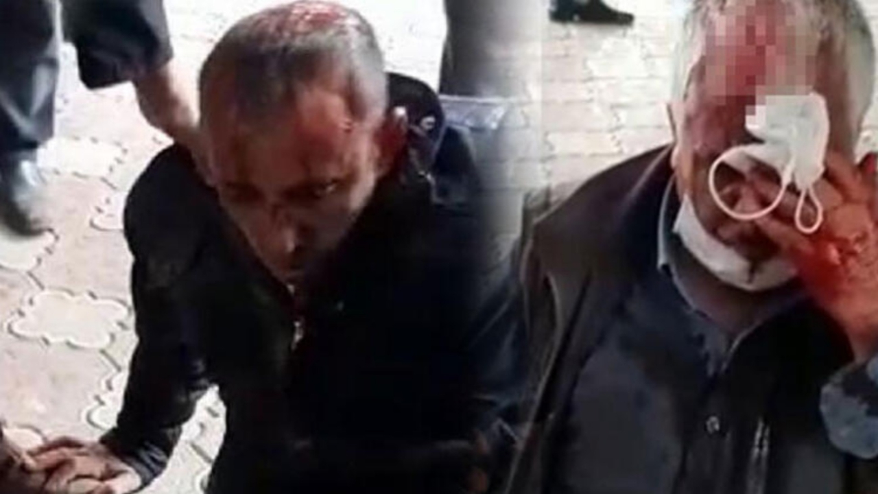 Maskesini çıkarıp kanları sildi! Pes dedirten kavga...