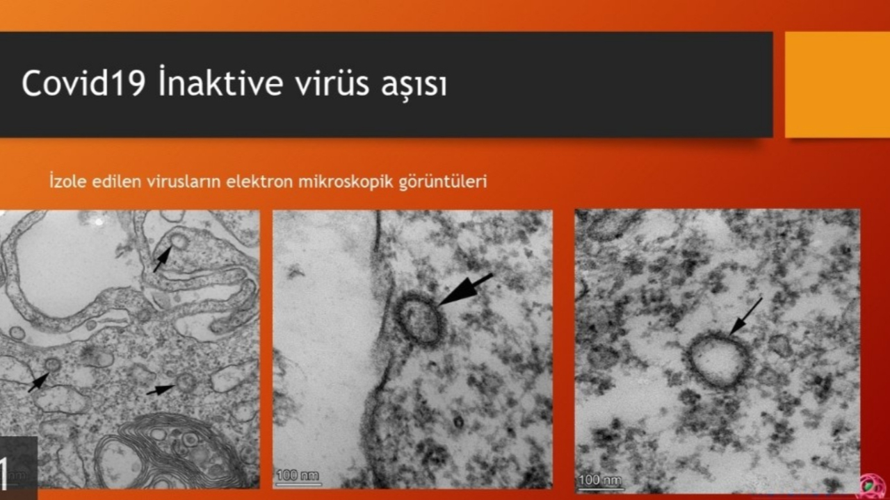 Ercüment Ovalı koronavirüs aşısının bulunduğunu açıkladı