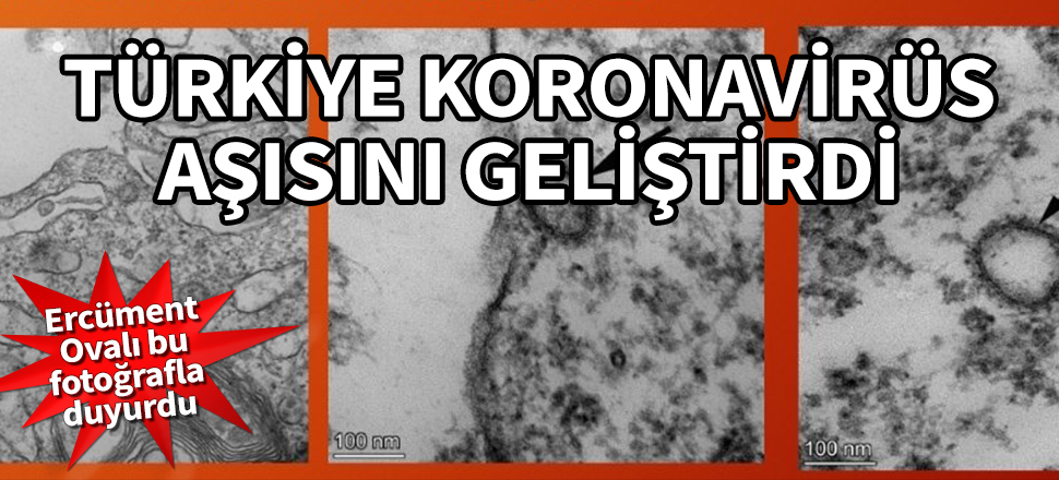 Ercüment Ovalı koronavirüs aşısının bulunduğunu açıkladı
