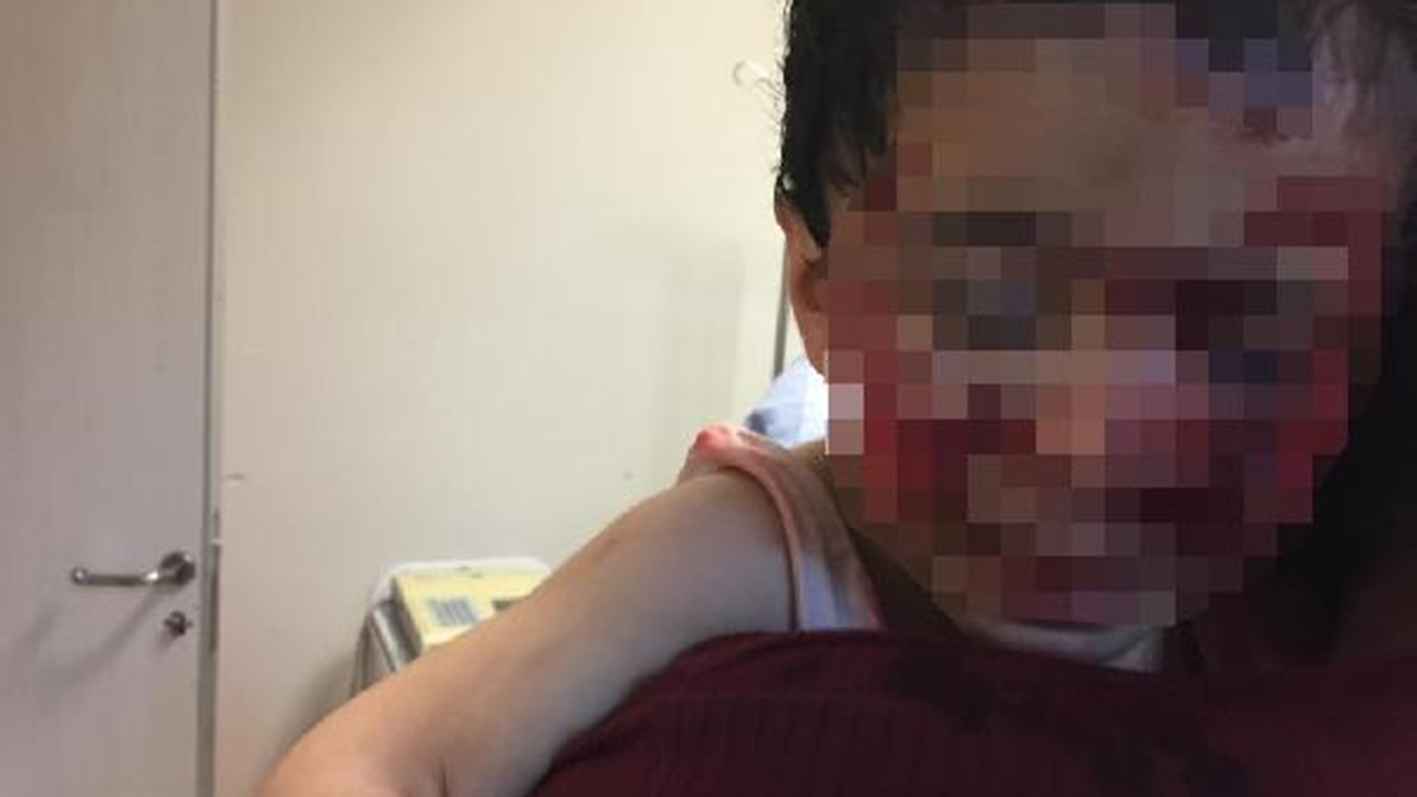Köpeklerin saldırısına uğrayan Davut'tan kötü haber!