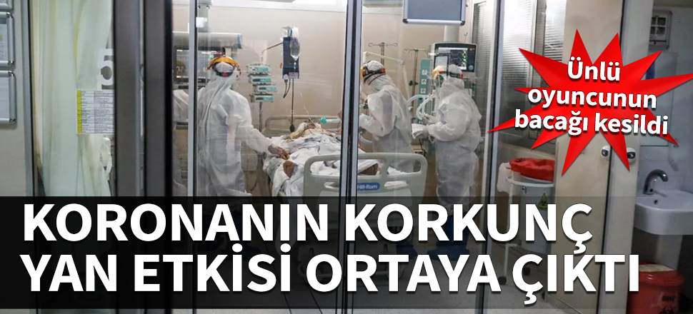 Koronanın korkunç yan etkisi ortaya çıktı! Ünlü oyuncunun bacağı kesildi...