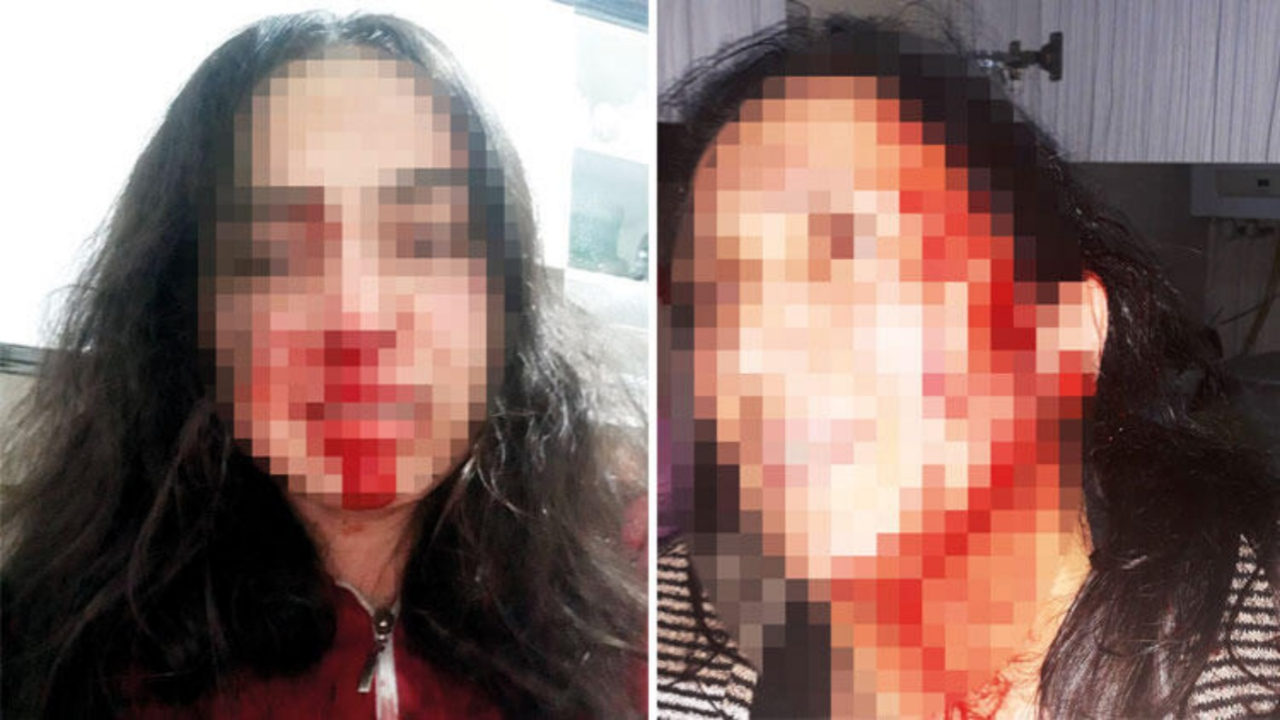 Korkunç! Annesinin kafasını, kardeşinin burnunu kırdı...